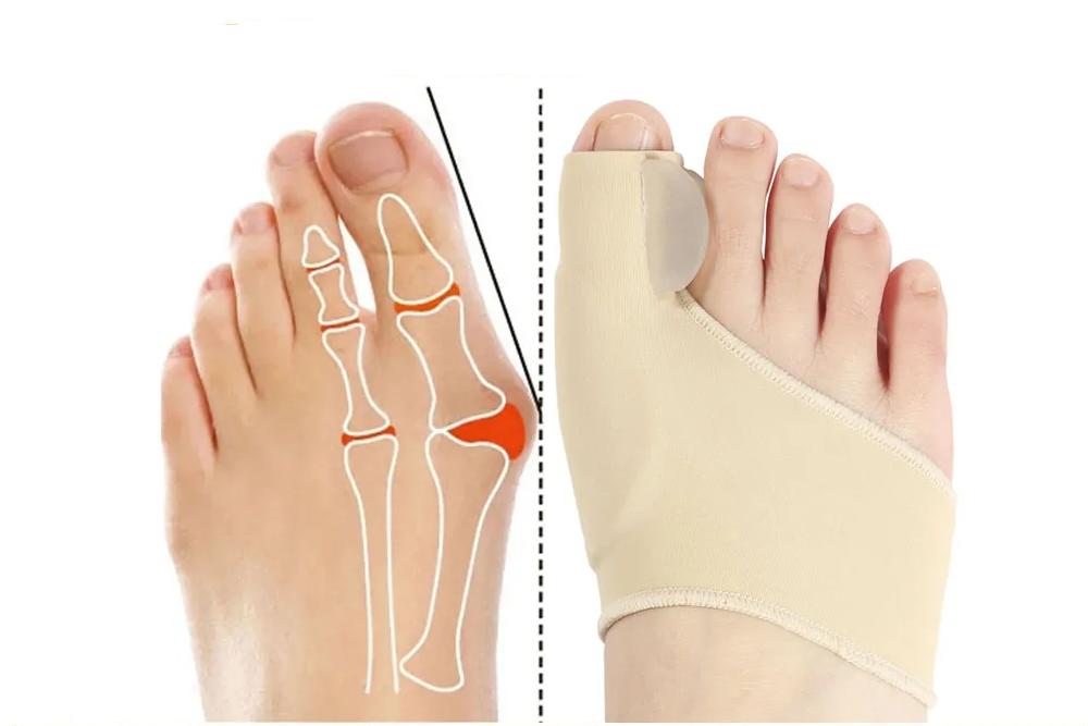 Toe Separator Hallux Valgus Bunion Corrector Orthotics Feet Bone Thumb Adjuster Correction Pedicure Sock Straightener Toe Separator Hallux Valgus Bunion Corrector Orthotics Feet Bone Thumb Adjuster Correction Pedicure Sock Straightener